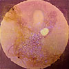 Floaters 1